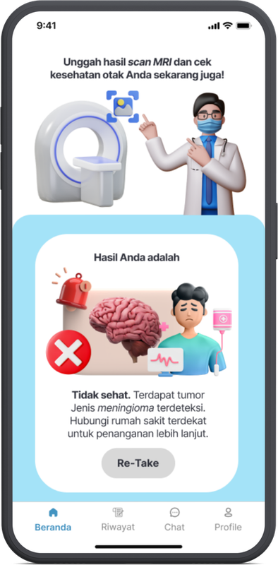 BrainHealth app screen showing a detected meningioma result